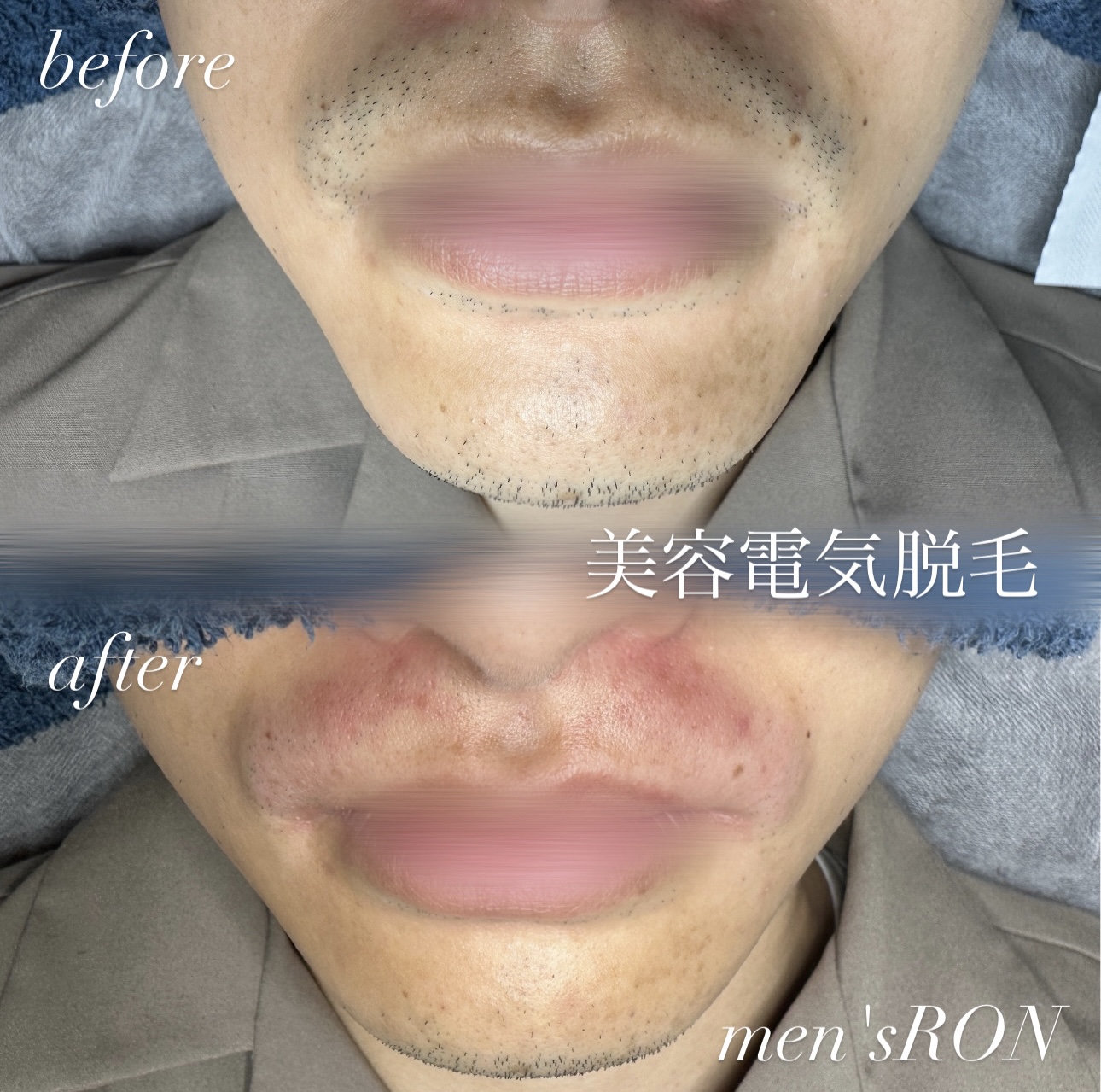 画像の説明