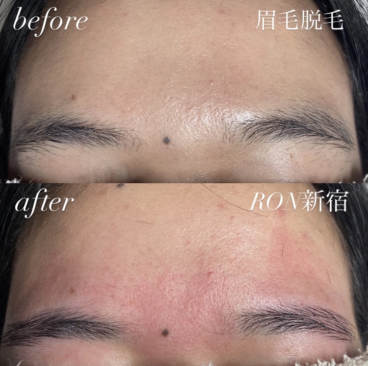 画像の説明 画像の説明