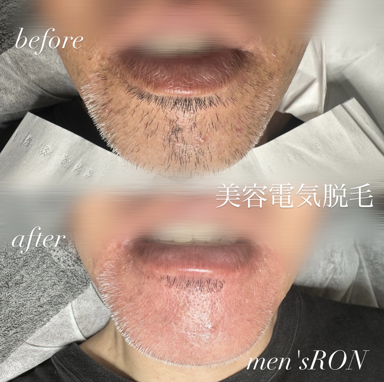 画像の説明 画像の説明