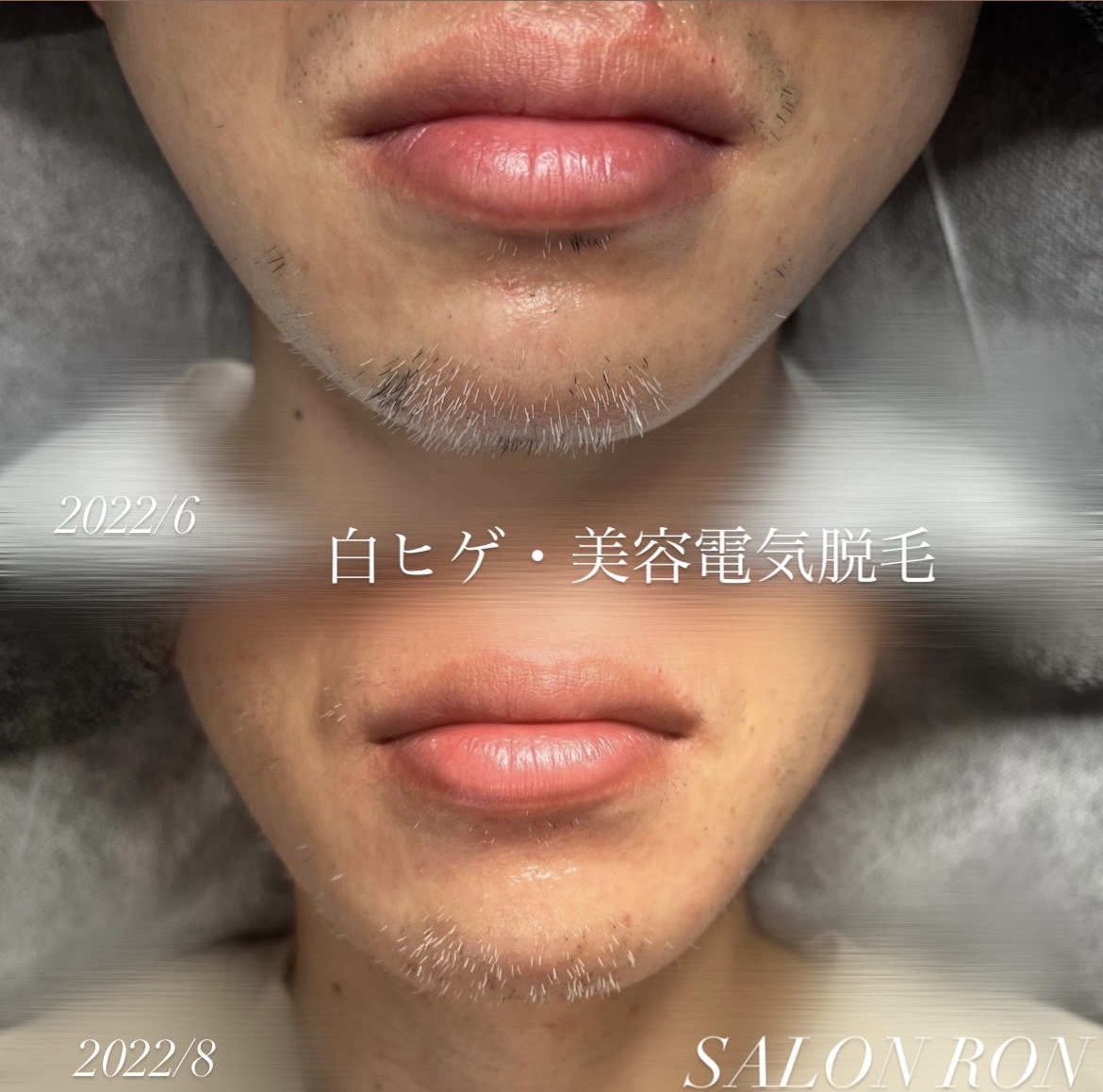 画像の説明