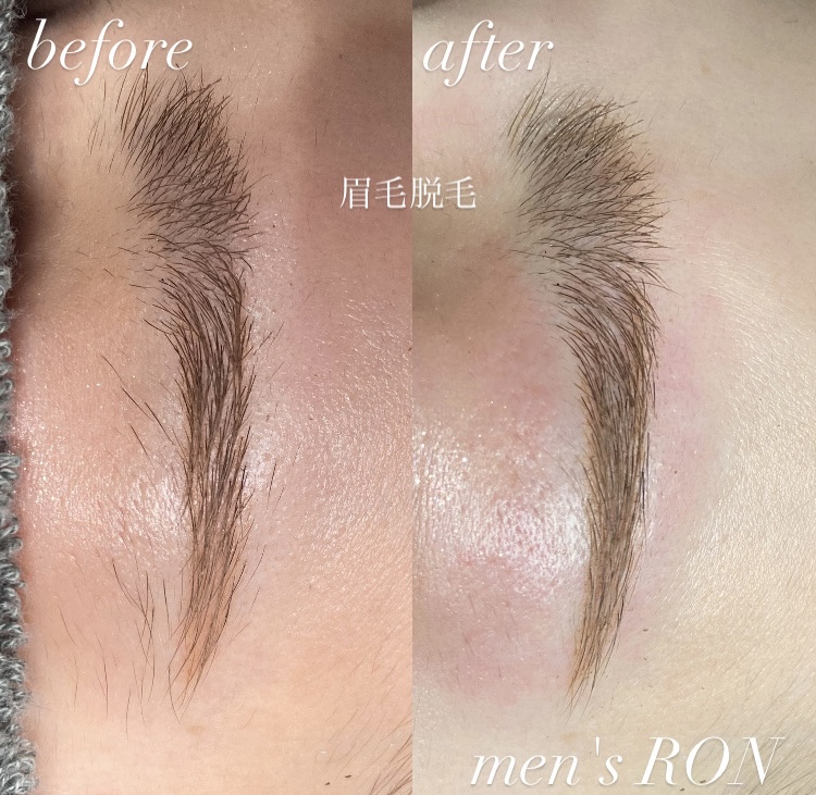 画像の説明 画像の説明