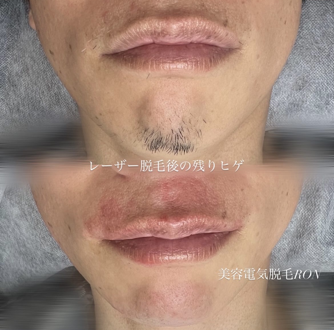 画像の説明 画像の説明