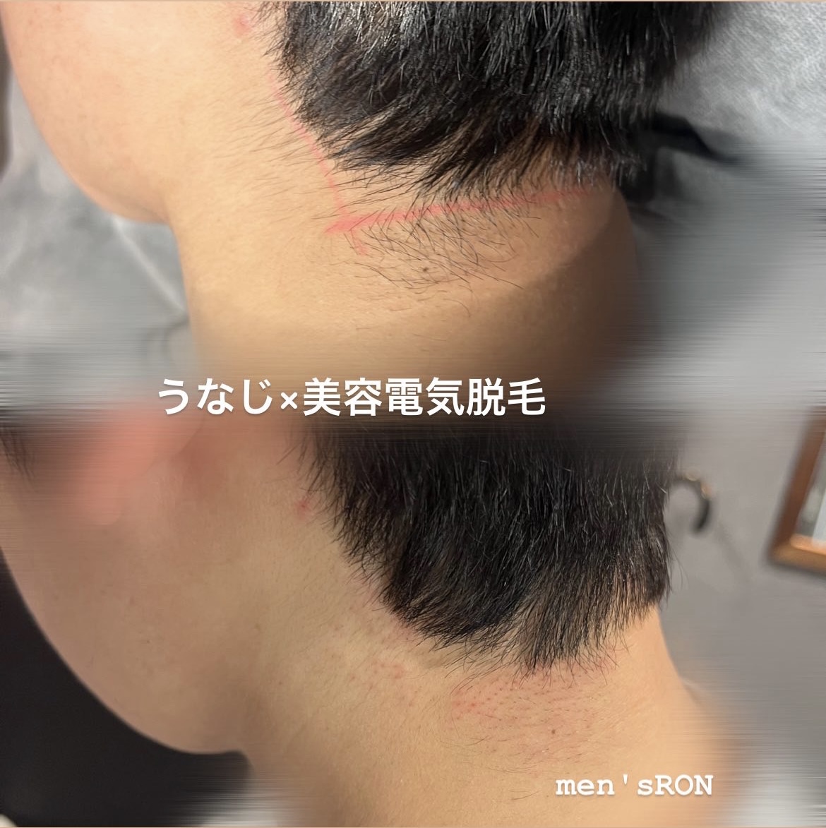 画像の説明