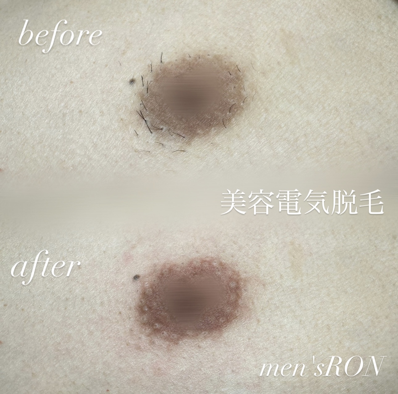 画像の説明