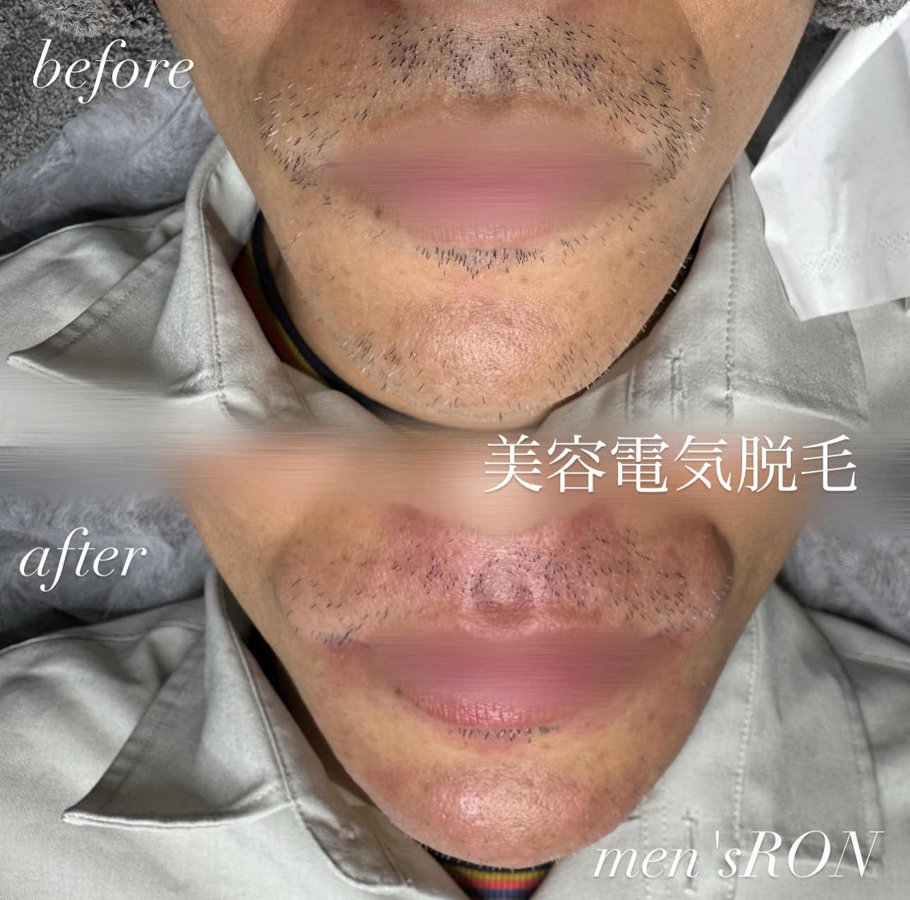画像の説明