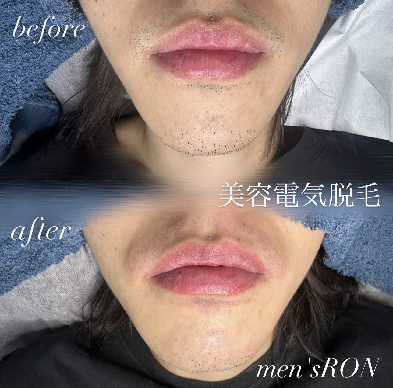 画像の説明