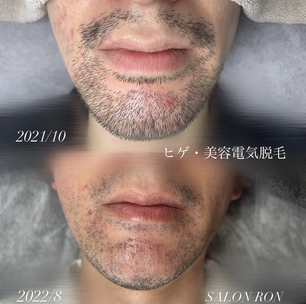 画像の説明