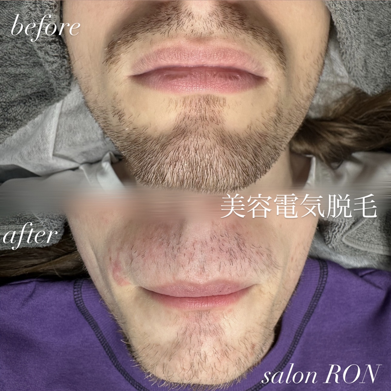 画像の説明 画像の説明