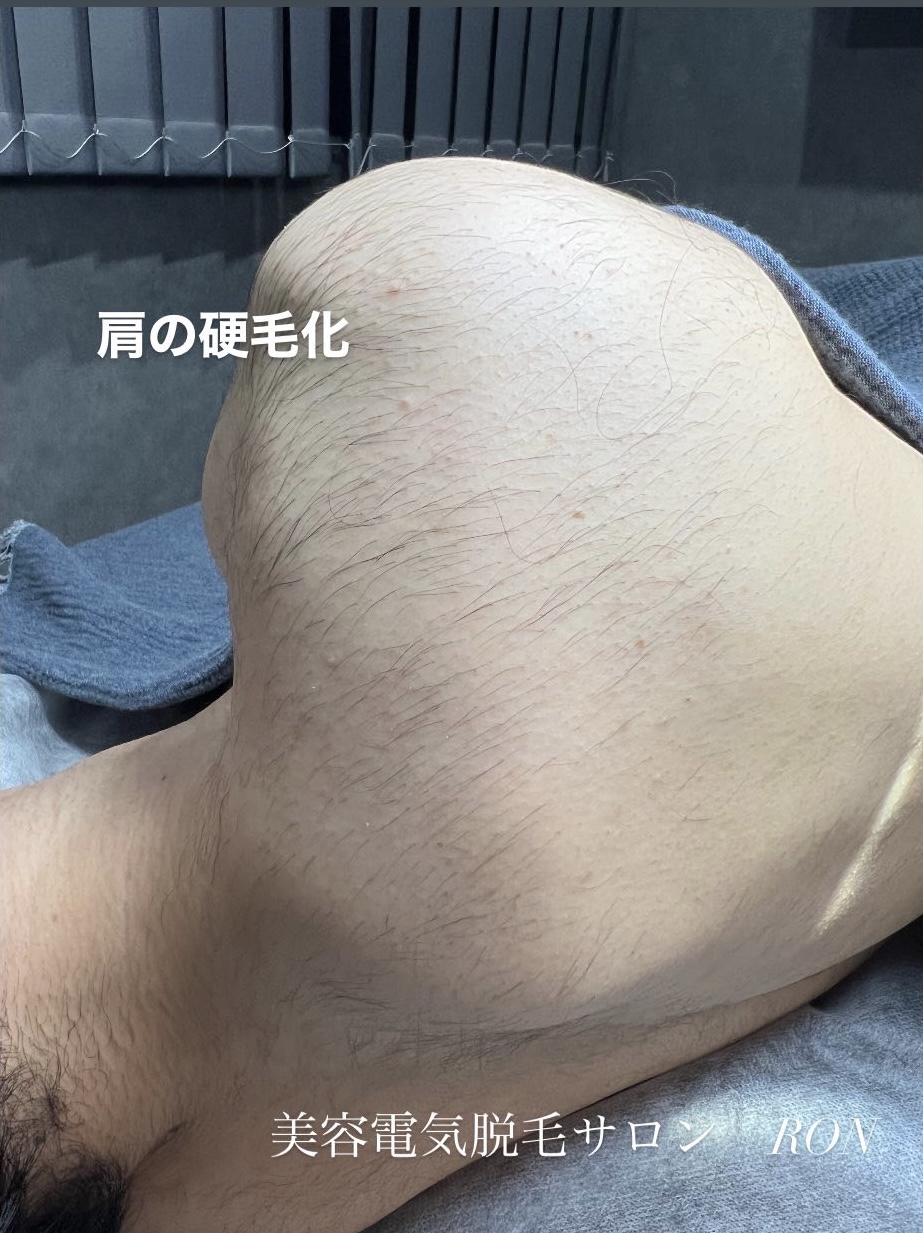画像の説明