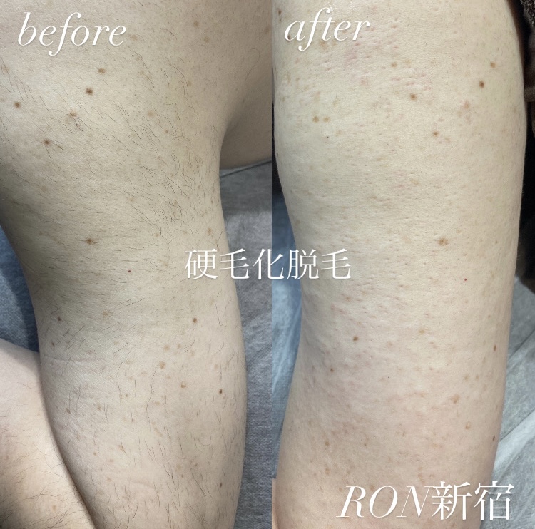 画像の説明 画像の説明