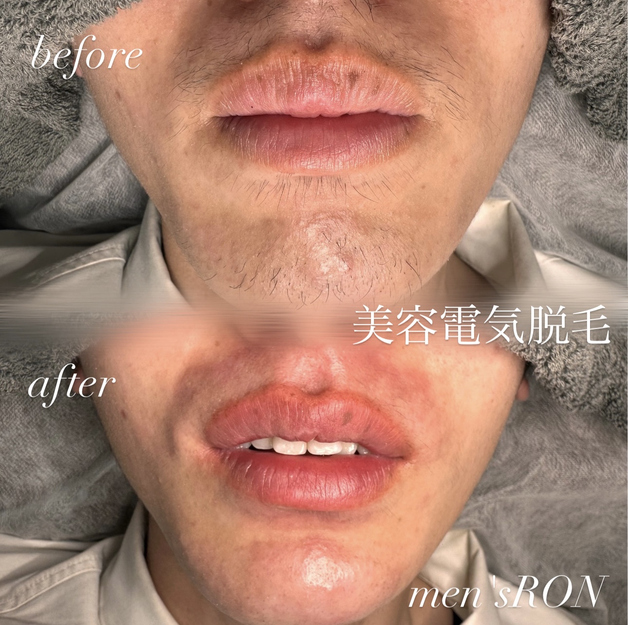 画像の説明