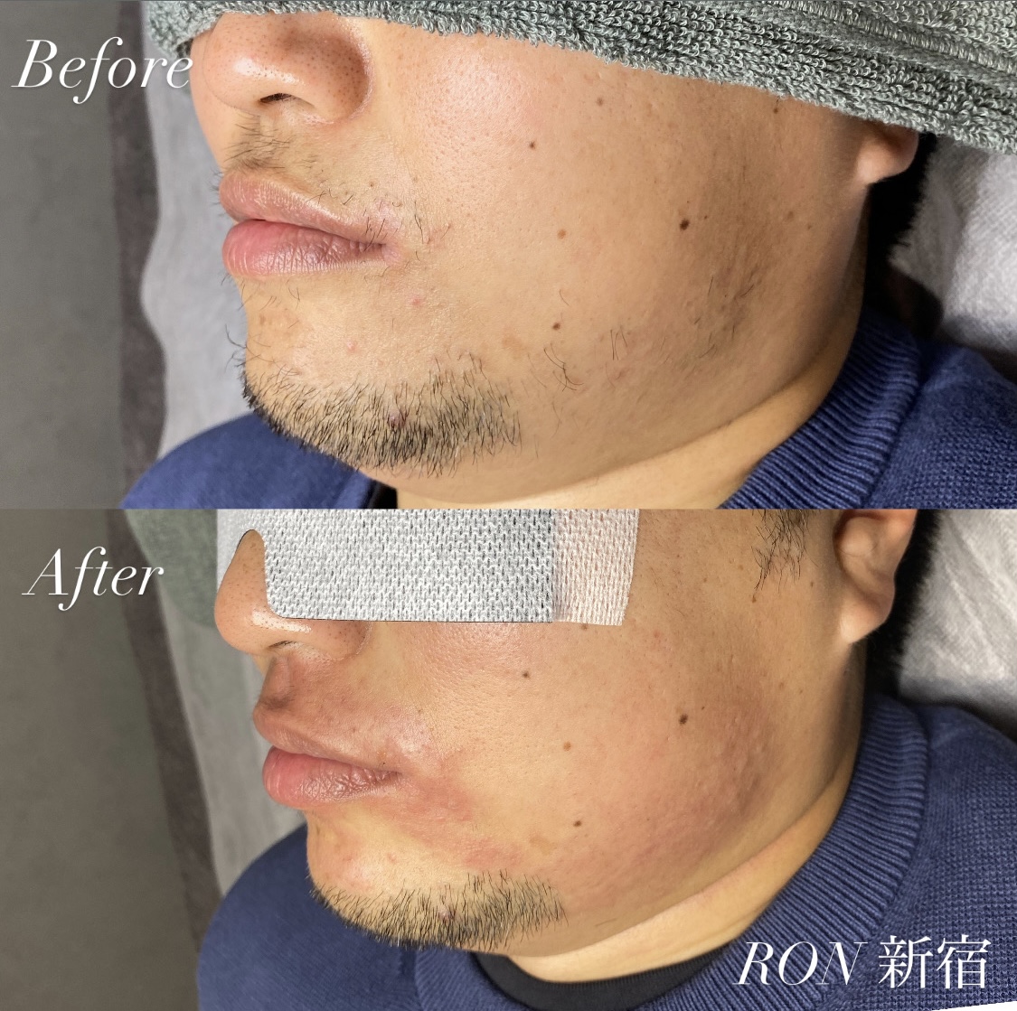 画像の説明 画像の説明