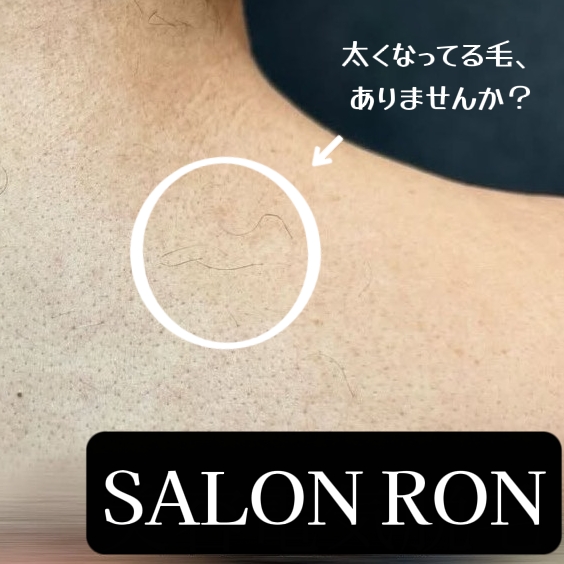 画像の説明