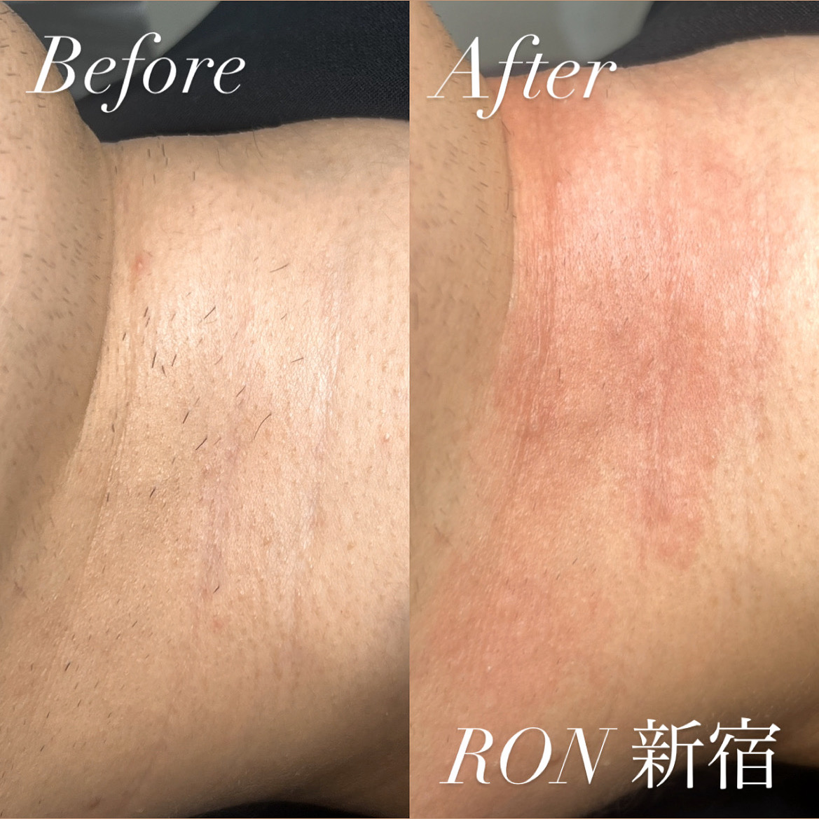 画像の説明 画像の説明