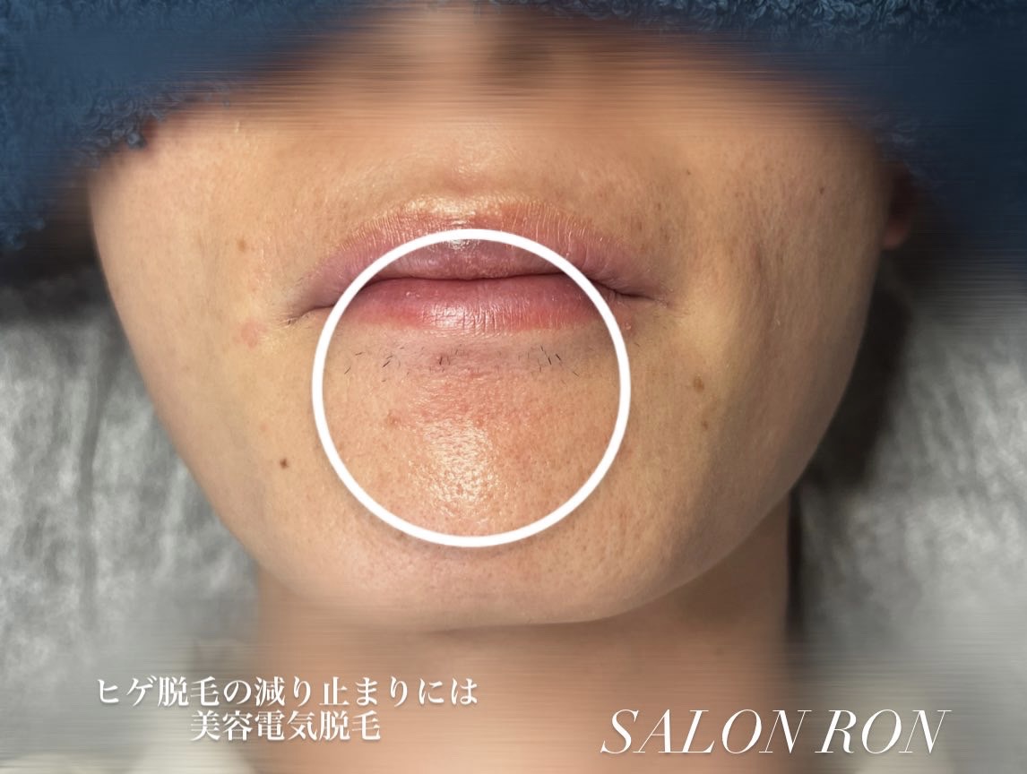 画像の説明 画像の説明