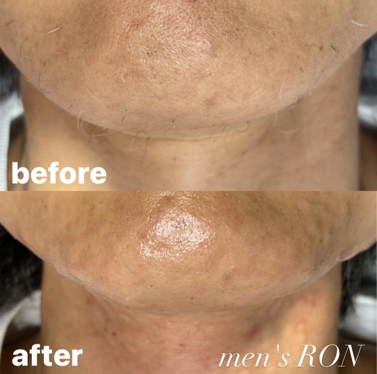 画像の説明 画像の説明