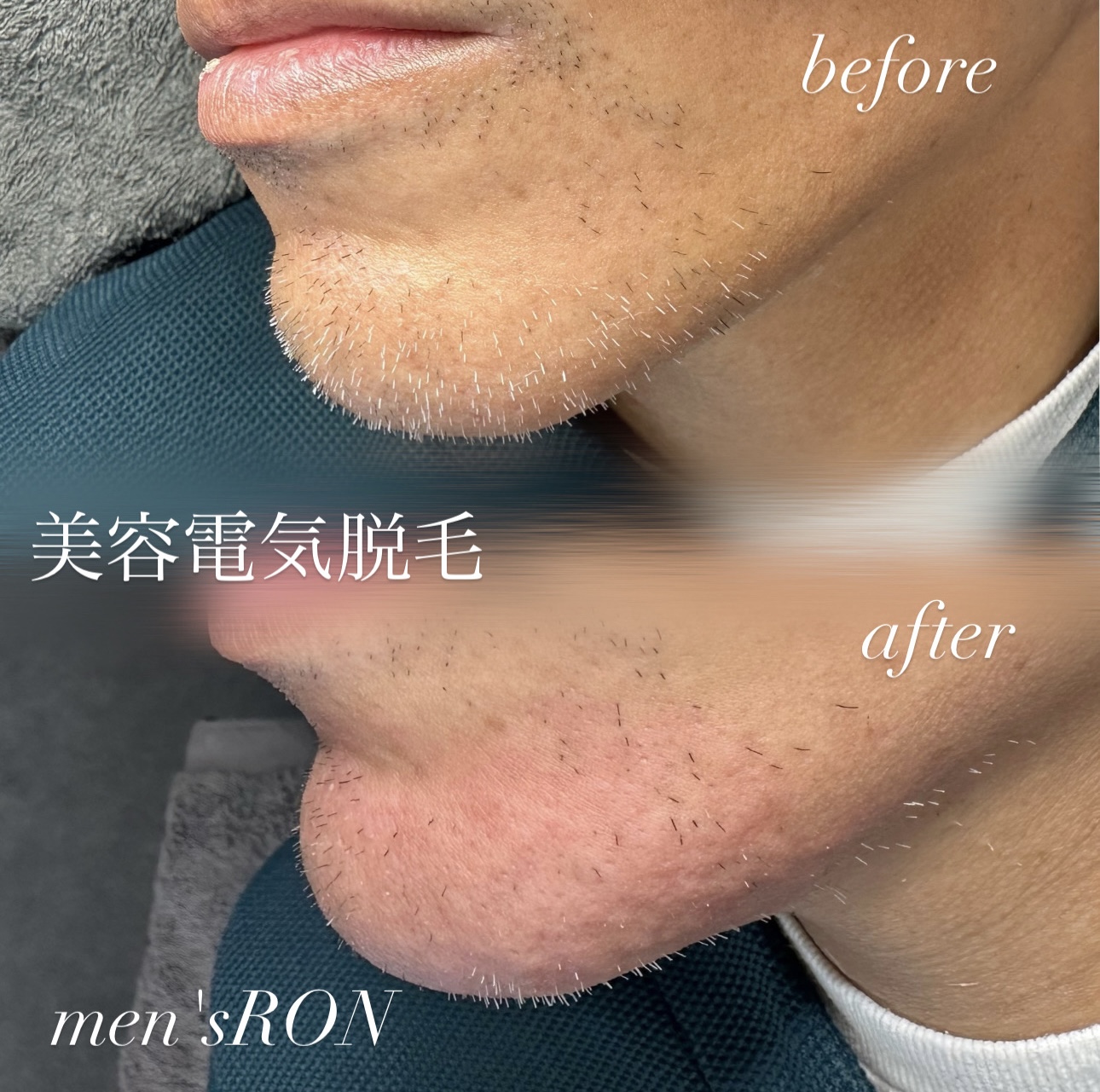 画像の説明 画像の説明