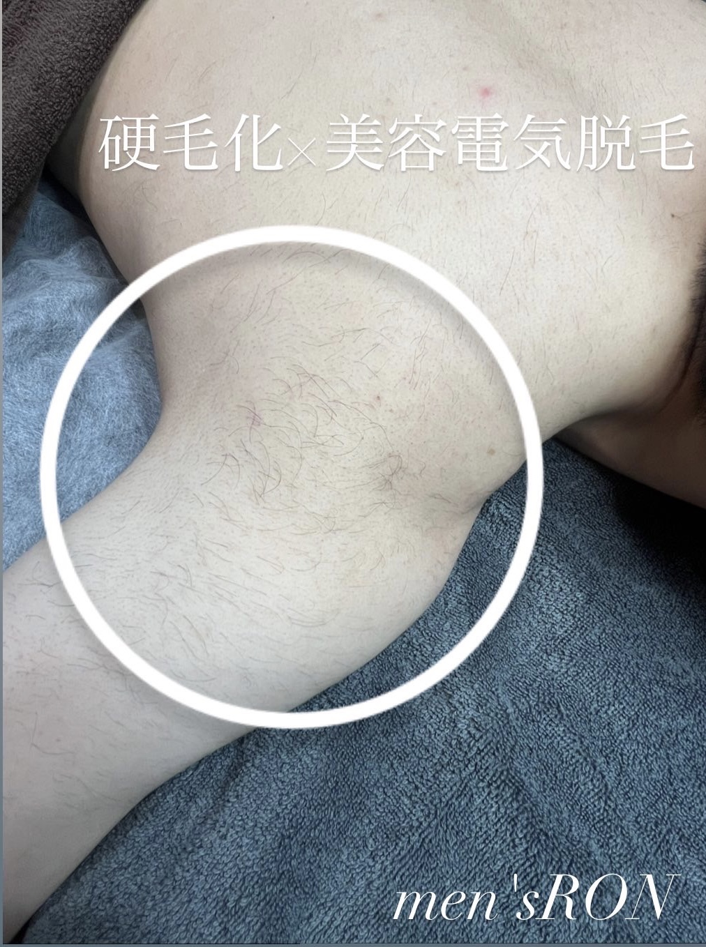 画像の説明