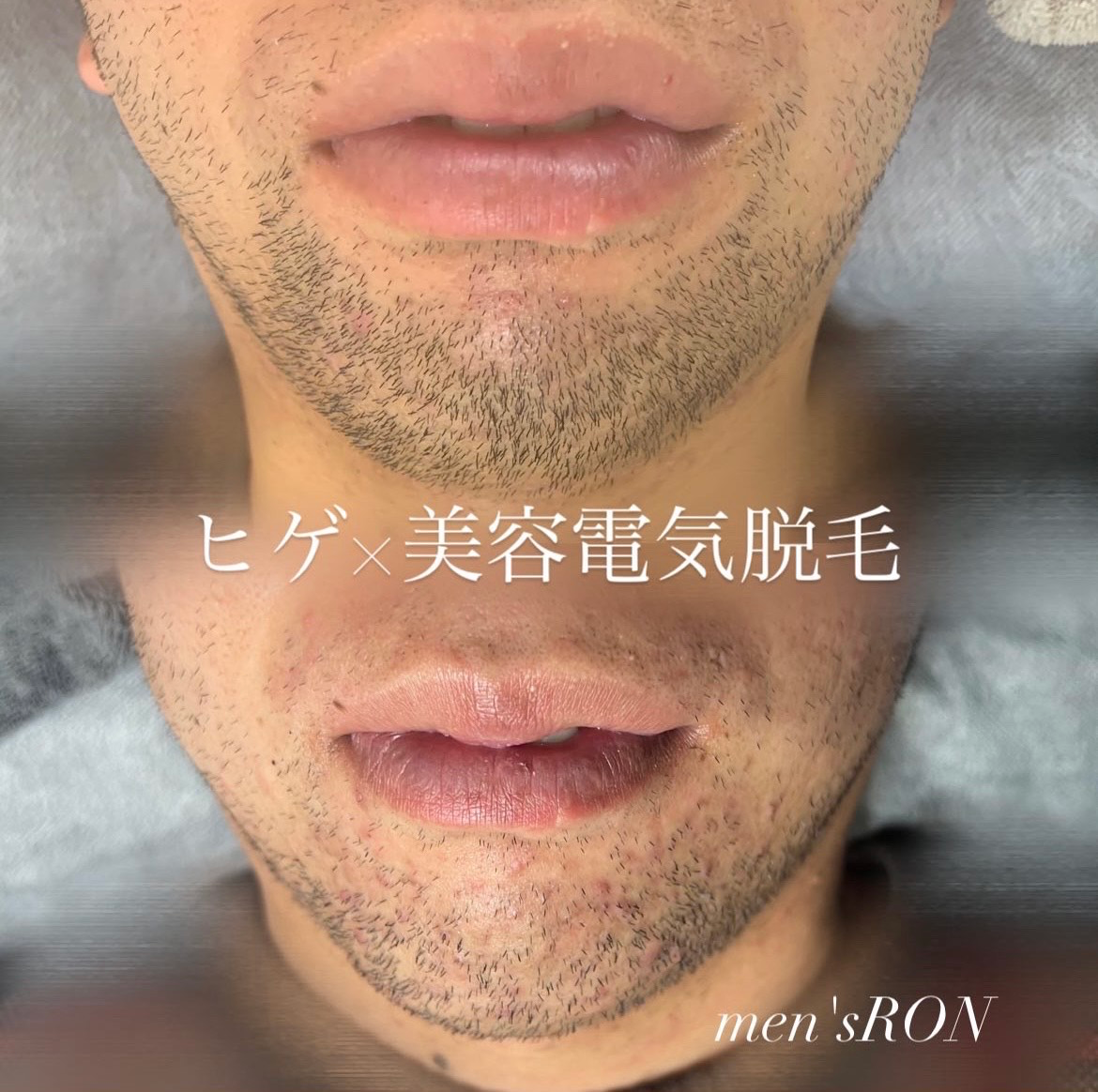 画像の説明
