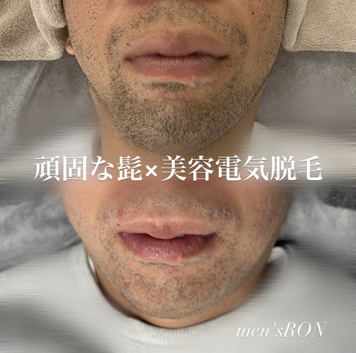 画像の説明