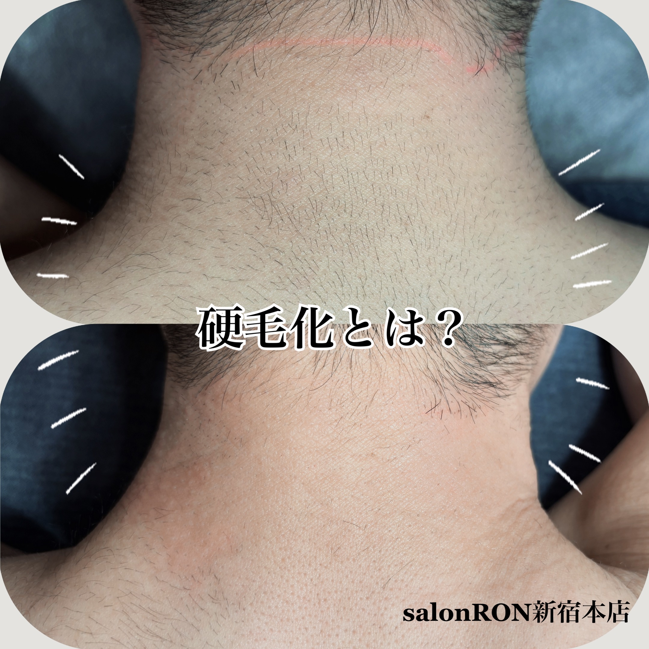 画像の説明