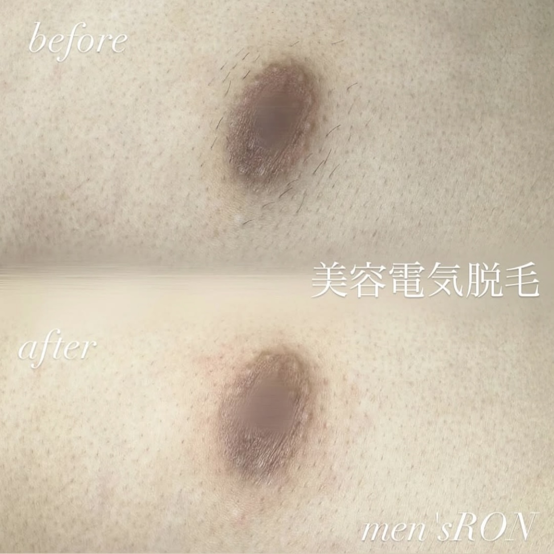 画像の説明 画像の説明