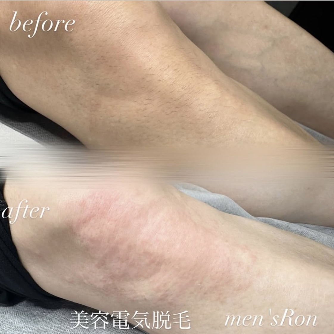 画像の説明