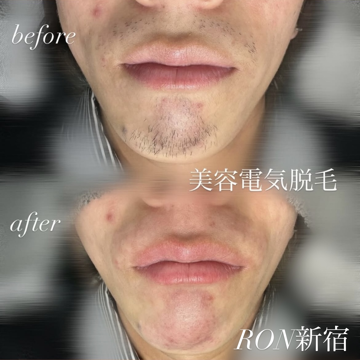 画像の説明