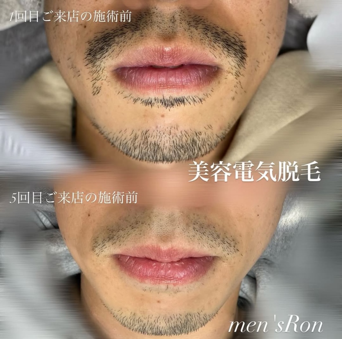 画像の説明