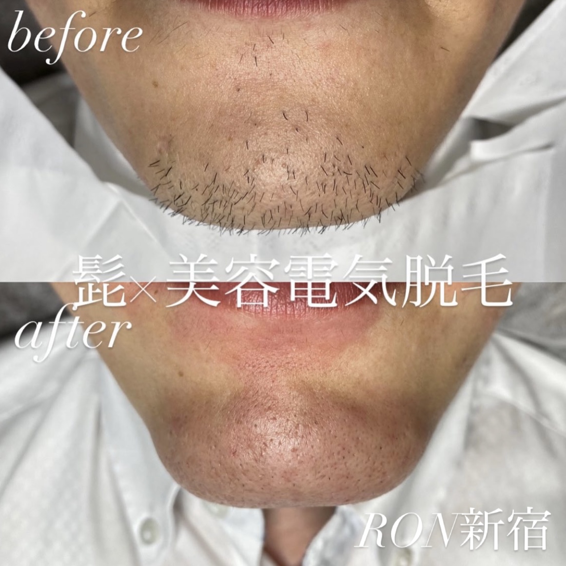 画像の説明 画像の説明