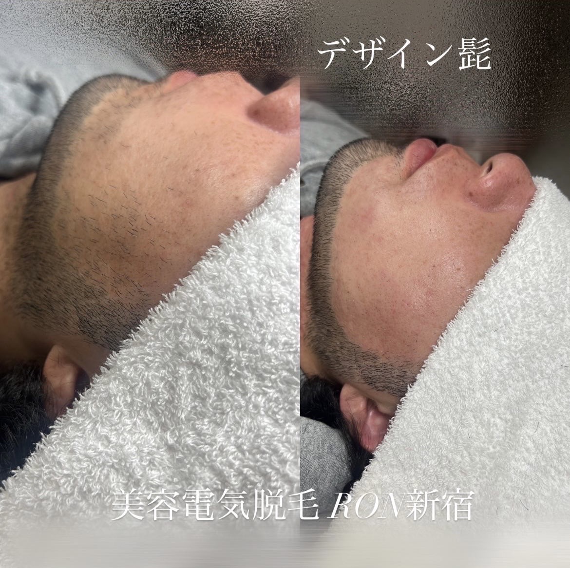 画像の説明