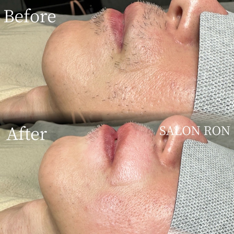 画像の説明 画像の説明