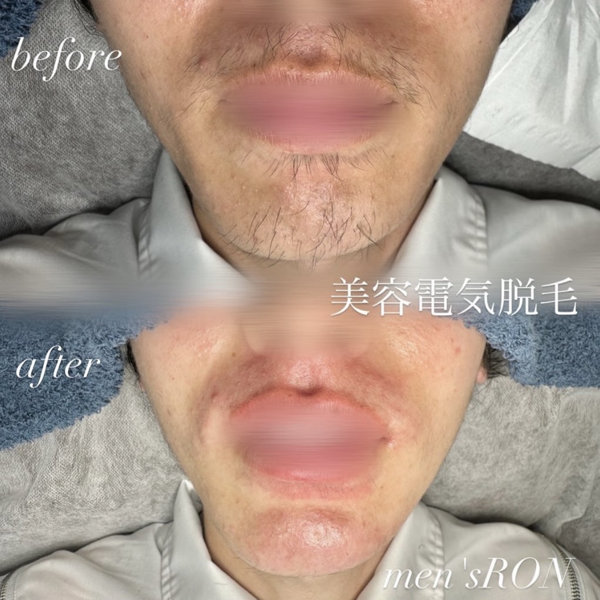 画像の説明
