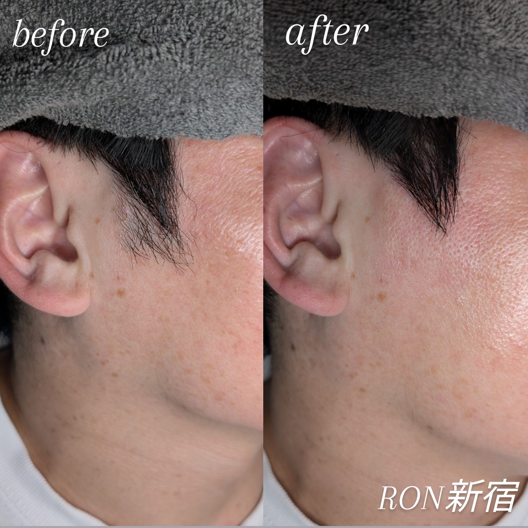 画像の説明 画像の説明