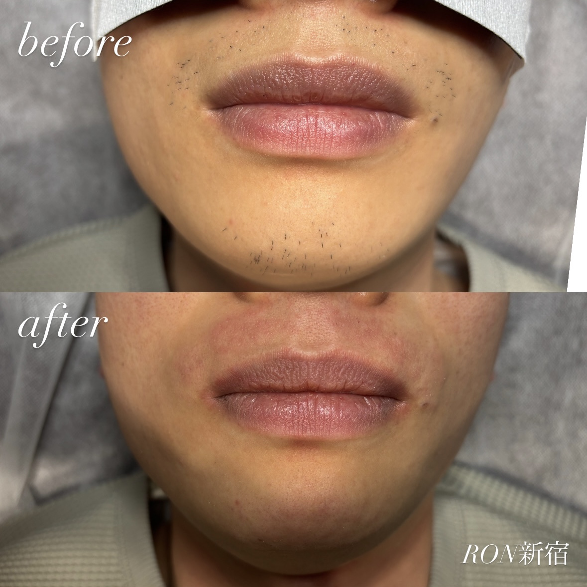 07C26E2C-3850-4410-B1E1-CB15E3891690 2