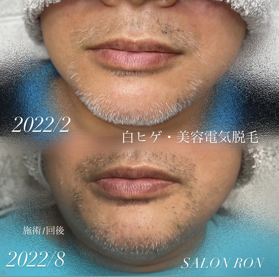 白髪8CB6FE0C-F6F8-4CDB-86AC-D802C6E8002B