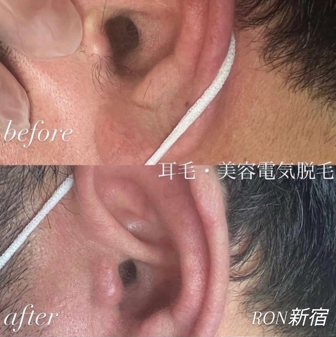 IMG_20251116_112258_094~2