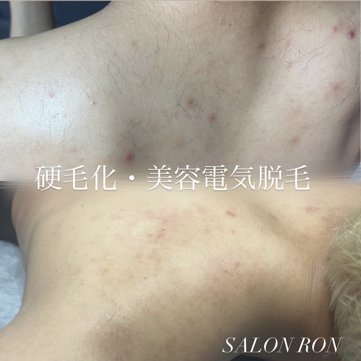 硬毛化BD03A316-7B9A-4A4F-9D24-94467C3E3A10