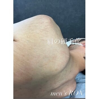 画像の説明