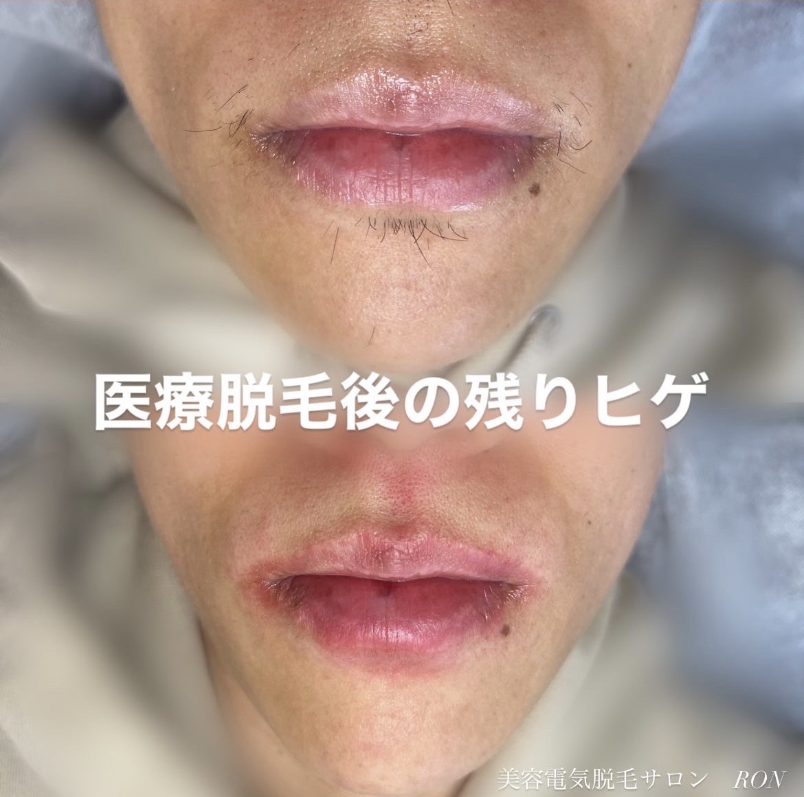 画像の説明