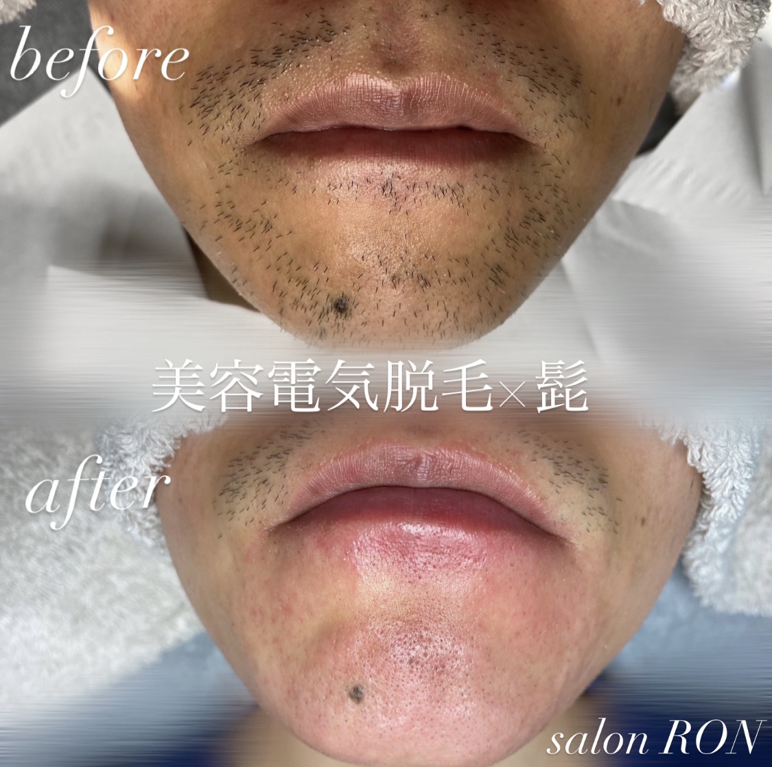 画像の説明 画像の説明