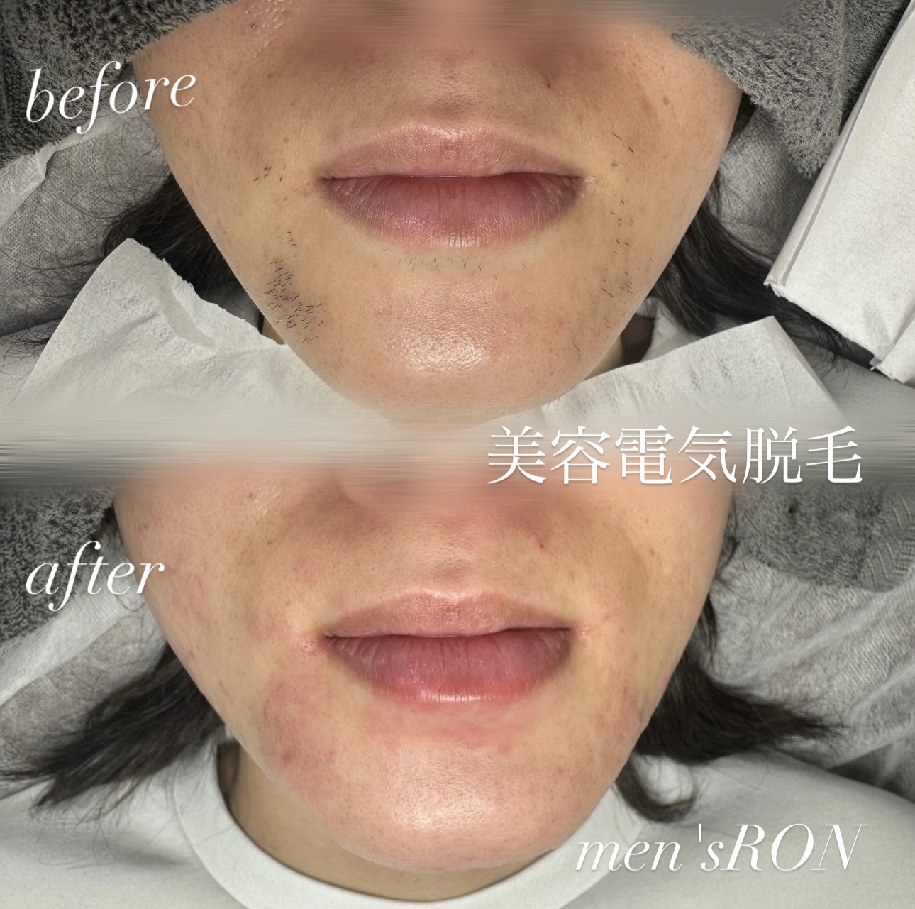 画像の説明 画像の説明